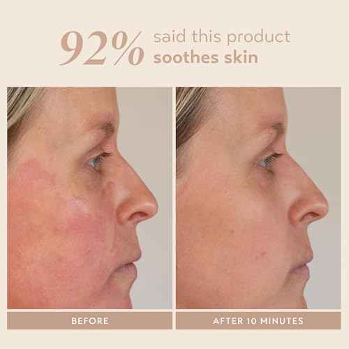 Doll 10 - Smooth Assist Overnight Facial 11% Triple-Acid Resurfacing Serum - Proven Overnight Transformation - Improves Skin Tone, Pores, Wrinkles & More - Vegan, Cruelty Free & No Parabens (1 oz)