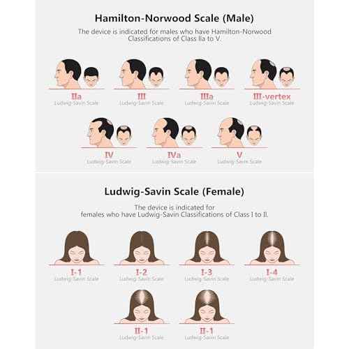 Red Light Therapy for Hair Growth, Laser Hair Growth Cap for Hair Loss, Rechargeable Battery- FDA Cleared Hair Growth for Men & Women, Wireless Red Light Hair Therapy, 162 Lasers
