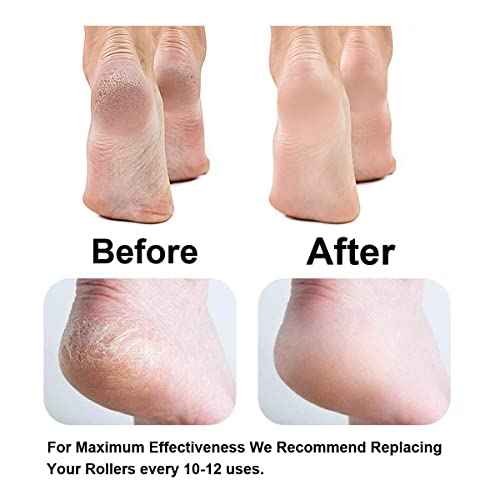 Replacement Roller Compatible with Dr. Scholl's Callus Remover Electronic Foot File-Extra Coarse (6 Pack)