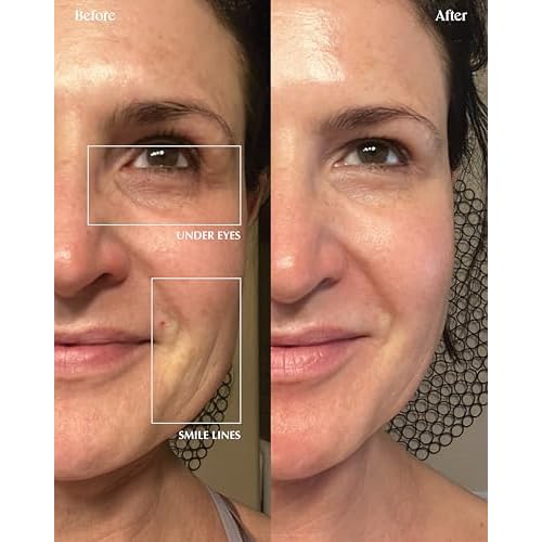 Dr. Medion Spaoxy Gel Advanced - Intensive Carbonated Skin Treatment Mask for Hydrated, Glowing Skin ? Dermatologist Developed CO2 Therapy Mask, Made in Japan