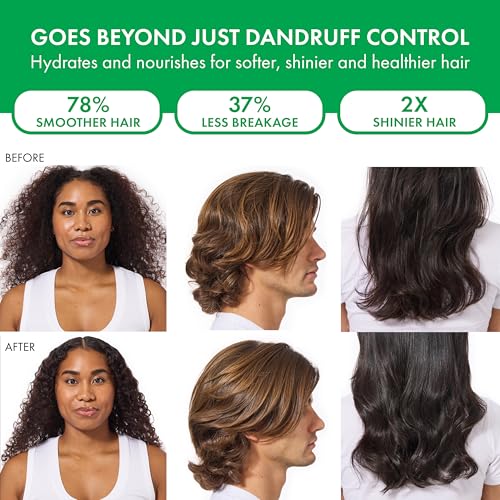 Dercos Selenium Sulfide Anti Dandruff Shampoo, Dry Scalp Treatment and Itch Relief. Prescription Strength Comparable to 2% Ketoconazole, for Mild to Severe Dandruff-Prone Hair & Flaky, Itchy Scalps