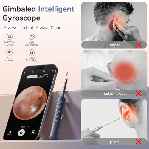 Ear Wax Removal Tool Kit: ZERONDER Ear Cleaner with Camera 1080P HD - Ear Canal Cleaning with 6 LED Lights for Adults & Kids