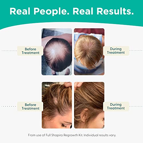 Shapiro MD Hair Growth Experts Leave-In Daily Foam, DHT Fighting Vegan Formula for Thinning Hair Developed by Dermatologists, Experience Healthier, Fuller & Thicker Looking Hair - 4 Month Supply