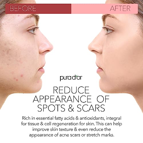 PURA D'OR 4 Oz ORGANIC Rosehip Seed Oil - 100% Pure Cold Pressed USDA Certified Anti-Aging Treatment - Vitamin A & C Rich - Helps Fade Appearance of Scars & Stretch Marks - For Face, Hair & Body