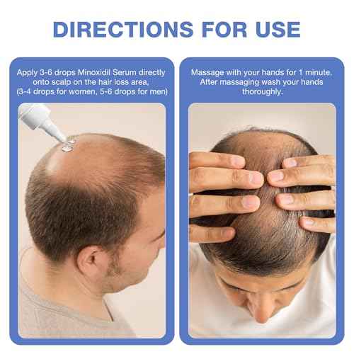 5% Minoxidil for Men, for Men & Women Hair with Biotin, Minoxidil for Beard Growth for Hair Loss to Hair Regrowth Get Thicker Fuller, Hair Loss Treatments for Women 100ml