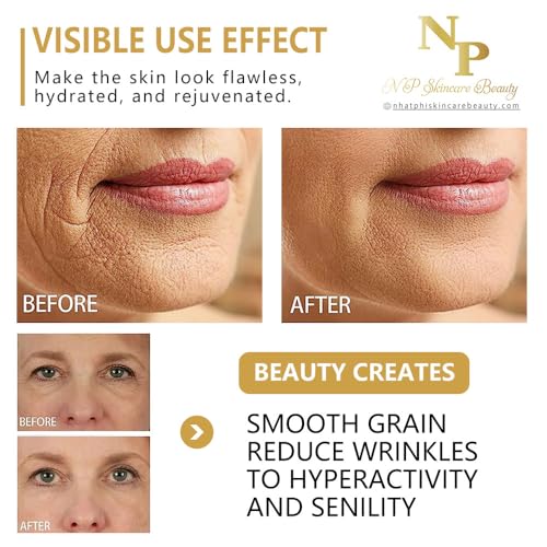 NP Skincare Instant Lift Cream with Vitamin C, Argireline, and Plant-Based Stem Cells for Moisturizing and Rejuvenated Skin - Visibly Reduces Wrinkles, Puffiness, and Dark Circles, 50 grams