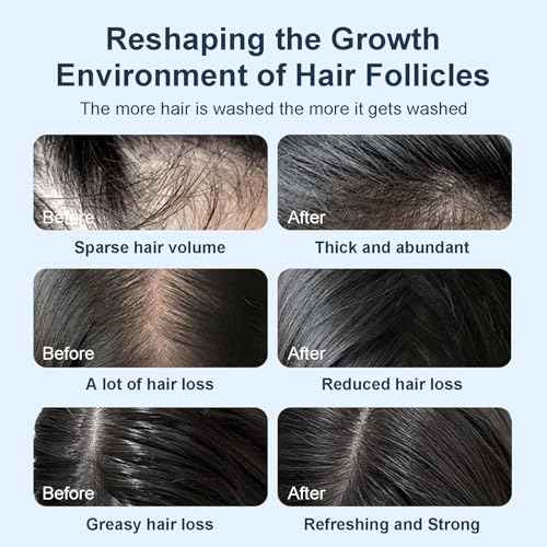 Tgideas Organic Biotin & Rosemary Hair Growth Shampoo ? Thickening Shampoo with Amino Acids for Hair Loss, Dandruff Control & Oily Scalp - for Women & Men