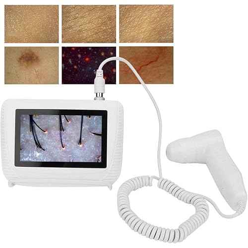 Skin Diagnosis Hair Analyzer, 5 Inch Screen Digital Skin Diagnosis Scanner System, Skin Hair Blackhead Scalp Detector Skin Hair Scalp Detector