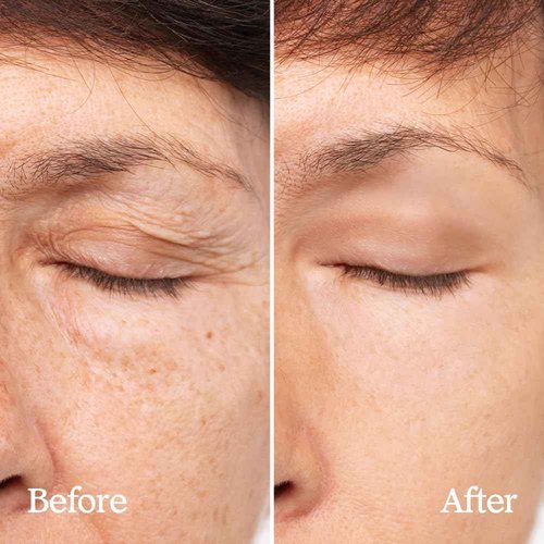 BeBebiome Revitalizing Cream (50ml / 1.7 Fl oz) Rich Texture, Skin Firning, Smoothing Fine Lines, Deep Moisturizer, Soothing, Postbiotics Skincare, NDP