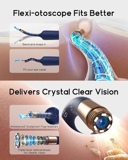 Bebird Earsight Plus D39R Ear Wax Removal Tool Camera, FSA HSA Eligible Items, Ear Cleaner with Flexible Ear Camera Otoscope, Visual Ear Pick Tweezers Wax Remover, Ear Cleaning Kit for Family