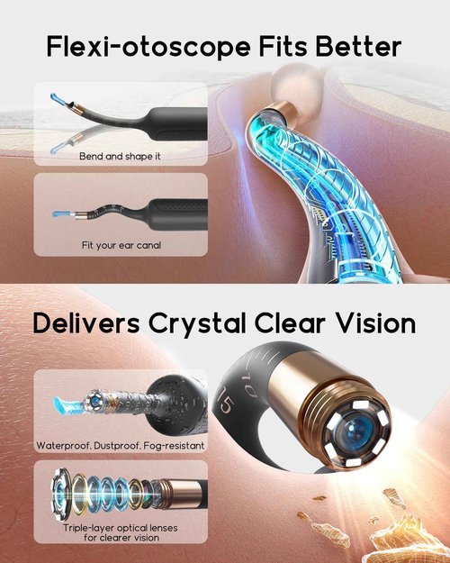 Bebird Earsight Plus R37R Ear Cleaning Camera Wax Removal Tool kit, Flexible Ear Scope Otoscope Camera Light, Visual Ear Picker Wireless Earwax Remover Tweezers for Adults & Kids