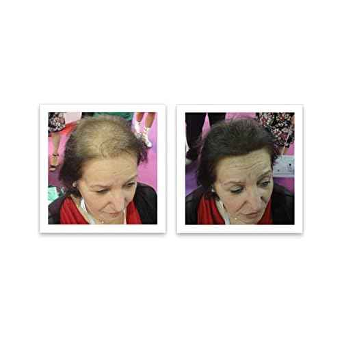 Caboki Hair Building Fiber + Built-In Spray Applicator (30-50 days supply). Dark Brown