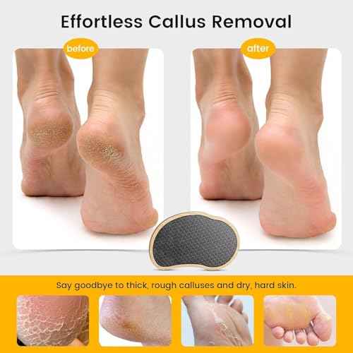 BEZOX Nano-Glass Pumice Stone for Feet Dead Skin, Eco-Friendly Pedicure Foot File Callus Remover - Bamboo Handle
