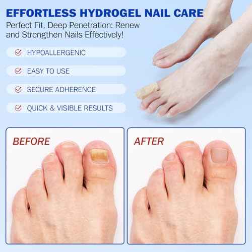 Nail Patches for 8-Hour Overnight Fast Hydrogel Nail Care, Keeps Feet Fresh & Dry All Day ? Men & Women (2)