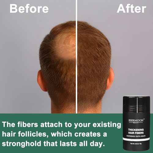 Hair Fibers, Hair Fibers for Thinning Hair, Hair Building Fibers, Hairpiece Filler, Increase Hair Density, Styling Powder for Women & Men, Hair Makeup, Premium Formula Thickening (DARK BROWN)