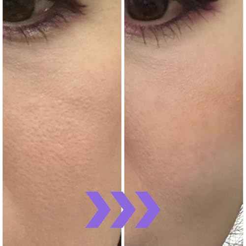 MizumaRi Skin-Refining Lift Cream for Sensitive Skin | Brightening, Hydrating & Jojoba Moisture Lock ? 30ml