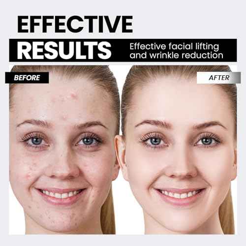 Microcurrent Facial Device,Latest Red Light Technology£¬Enhances The Ability to Lift The Face and Tighten The Skin£¬Facial Wrinkle Equipment£¬Smart Photon Micro-Current Device, Model:EP-300.