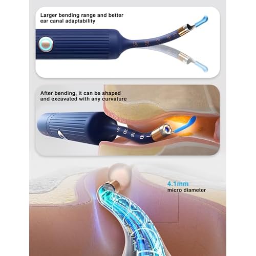 BEBIRD Earsight Plus Ear Wax Removal Tool Camera with HD Visual Otoscope, Smart WiFi Earwax Cleaner Kit, Safe Silicone Flexible Scoops & Tweezers Tools for Adults & Kids (Blue)