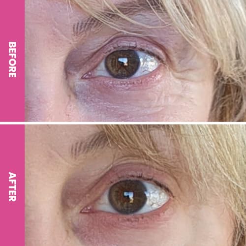 PRIME PROMETICS PrimeEyes Hydrate Under Eye Cream for Mature Women ? Hydrating Eye Cream for Dark Circles and Wrinkle Repair ? Soft, Glowing & Healthy Under Eyes