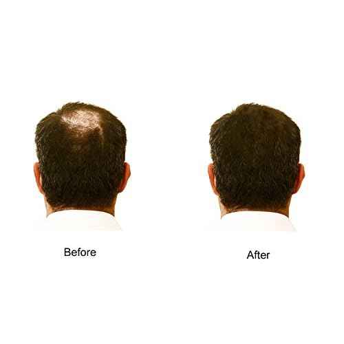 My Secret Hair Enhancer Medium Brown 5oz 3 pack