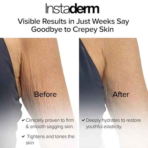 Crepe Fix Body Restorative Cream ? Anti-Aging Wrinkle Cream, Support Skins Natural Elastin & Collagen Production to Restore, Lift, Tighten, Hydrate & Smooth Thinning Aged Crepey Skin. 8OZ