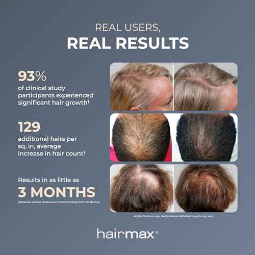 HairMax Laser Band 41 - (FDA Cleared) Hair Growth Device - Restores Natural Hair Cycle with Red Light Therapy