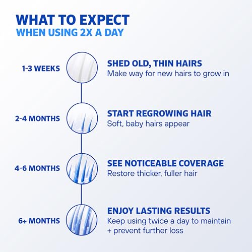 Men¡¯s Rogaine 5% Minoxidil Topical Foam, One Month Supply