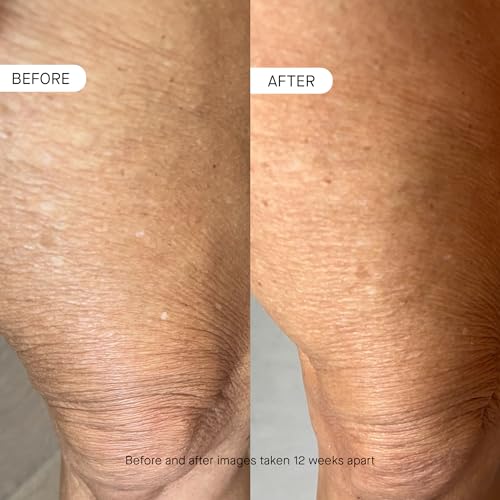 OneSkin BODY OS-01 Peptide Skin Longevity Daily Moisturizer- Improves Skin Texture & Barrier, Safe for Sensitive Skin
