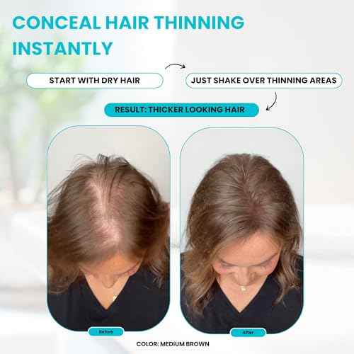 SURETHIK Hair Fibers, 30g (Dark Brown), Fills Thinning Hair for Visibly Fuller Look, Conceals Bald Spots, Natural Look, For Men & Women