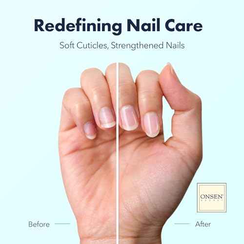 Onsen Secret Nail & Cuticle Repair Oil (10ml) - Dry Oil Formula - Japanese Tsubaki, Tea Tree & Jojoba - Strengthens Nails, Repairs Cuticles, Hydrates Skin & Hair - Natural & Vegan