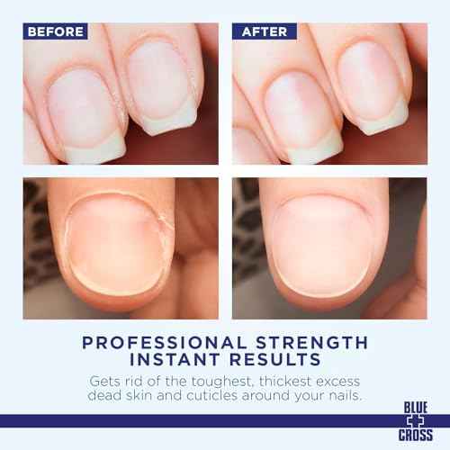 Blue Cross Cuticle Remover Liquid, Cuticle Softener for Nails, Professional Nail Care with Lanolin for Brittle Hang Nails, Hydrating, Moisturizing, Dry Cuticles, Made in USA, 32oz