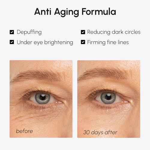 MAREE Under Eye Balm Stick Hydrating - Retinol Caffeine Under Eye Brightener Stick for Older Women - Collagen Under Eye Cream for Dark Circles & Wrinkles - Skin Care Treatment Moisturizer