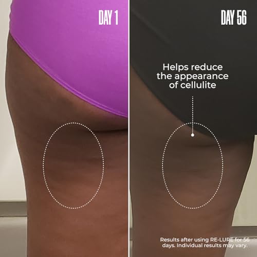 MA?LYS RE-LURE Tight & Tone Body Serum - Hyaluronic Acid Serum for Women - Hydrating, Helps Reduce The Look Of Cellulite