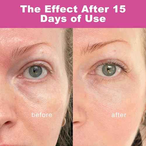 Vitaliq Cemenrete, Calcium Volume Multi Balm,Korean Collagen Moisturing Stick,Repair moisturizing Cream,Anti-aging,Hydrating,Firming Skin, Almond & Vitamin E for Neck, Face (2PCS)