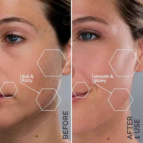 Michael Todd Beauty - Sonicsmooth ? SONIC Technology Dermaplaning Tool - 2 in 1 Women¡¯s Facial Exfoliation & Peach Fuzz Hair Removal System with 8 Weeks of Dermaplaning Blades