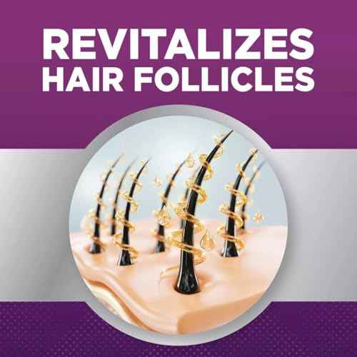 Minoxidil 5% Hair Growth Foam for Women | Unscented Once-A-Day Treatment for Thicker, Fuller Hair | Clinically Proven, Regrowth Solution for Thinning Hair | 2-Month Supply | Perrigo & Kirkland& Costco