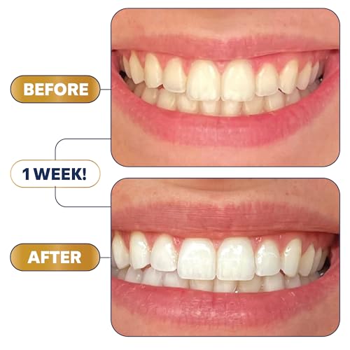 Lumineux Teeth Whitening Strips - 21 Treatments - Peroxide Free - Enamel Safe for Whiter Teeth - Whitening Without The Sensitivity - Dentist Formulated - Sensitivity