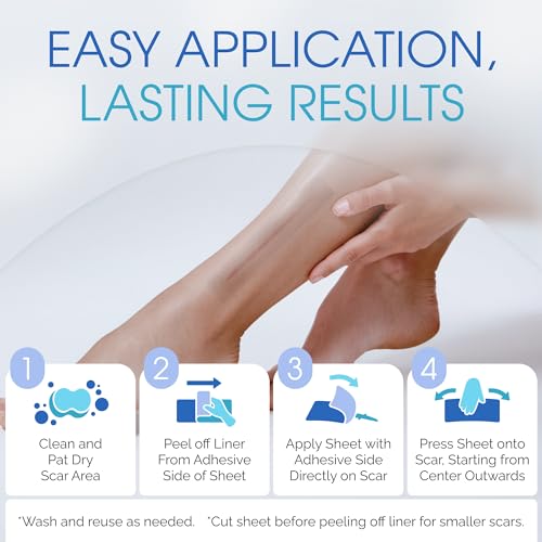 Medical Grade Silicone Scar Sheets - Long Water-Resistant Silicone Scar Tape - Advanced Solution for Surgical Scars, Stretch Marks, and Keloids - 7-Inch Strips, 12-Pack
