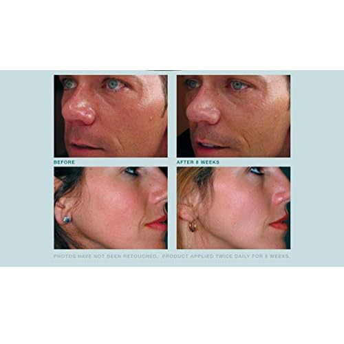 Anti Aging face Cream TRIPLE Antioxidant Treatment Serum For Face, Resveratrol + Green Tea + Caffeine - Visibly Reduce Skin Redness & Calm Irritation -For Sensitive Rosacea Skin -1oz