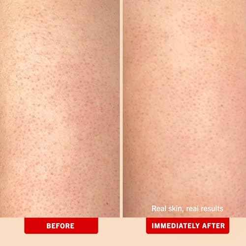 First Aid Beauty - KP Bump Eraser Body Scrub with 10% AHA, Keratosis Pilaris Exfoliator with Glycolic and Lactic acids, Helps Reduce Chicken Skin Bumps, Safe for Sensitive Skin, Peach Scent (8 oz)