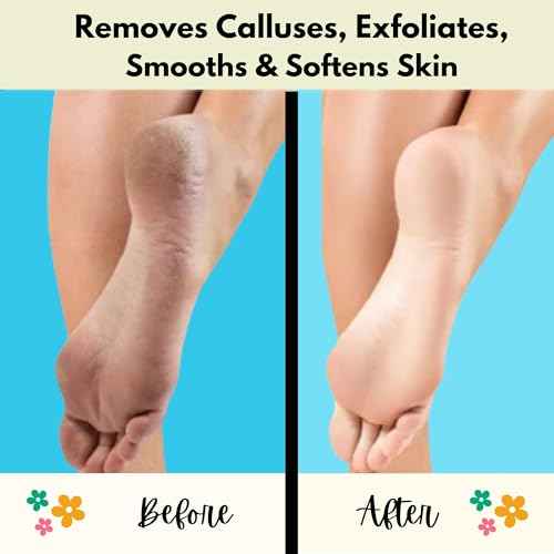Mr. Pumice Callus Remover PUMI Bar: Pedicure Stone & Foot/Heel Scrubber - Medium Grit (Assorted Colors) 4 Pack