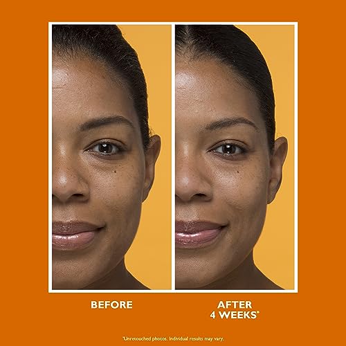 Peter Thomas Roth | Potent-C¢â Brightening Vitamin C Moisturizer