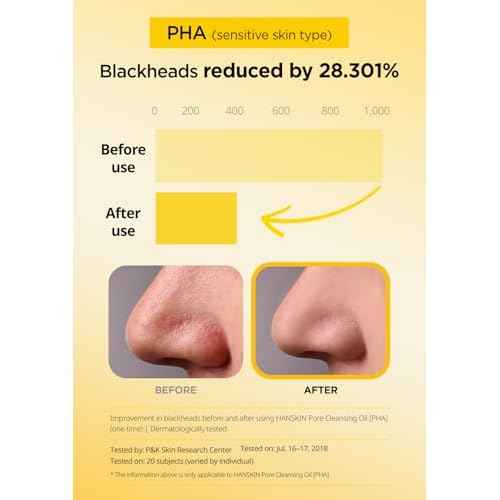Hanskin Pore Cleansing Oil, Oil Cleanser for Face, Makeup Blackhead Sebum Remover, Korean Deep Pore Cleanser for Sensitive Skin [PHA] (10.14 oz)