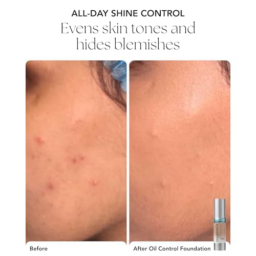 Oxygenetix Oil Control Foundation | Breathable Makeup for Face | Lightweight, Non-Comedogenic Coverage with Salicylic Acid | Longwear Foundation for Oily or Sensitive Skin
