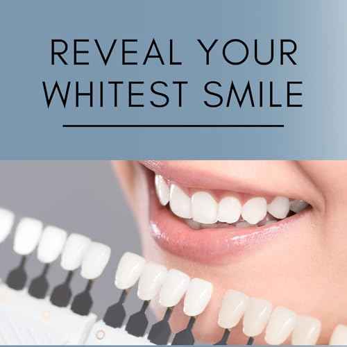 Teeth Whitening Gel for Trays - Pro Strength 44% Carbamide Peroxide, 5 Syringes (50 Treatments) + 2 Trays ? Enamel Safe, Removes Coffee & Other Stains