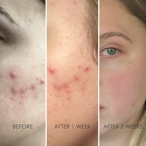 REFLEKT 4 Smoothing Squalane Eye & Lip Treatment Cream