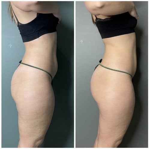 Guam Anti Cellulite Seaweed Wrap ORIGINAL FORMULA | Skin Tightening Cellulite Treatment For Thighs And Legs Inches Reduction - Hot Mud Thigh Wraps For Cellulite Removal, 1KG Beauty