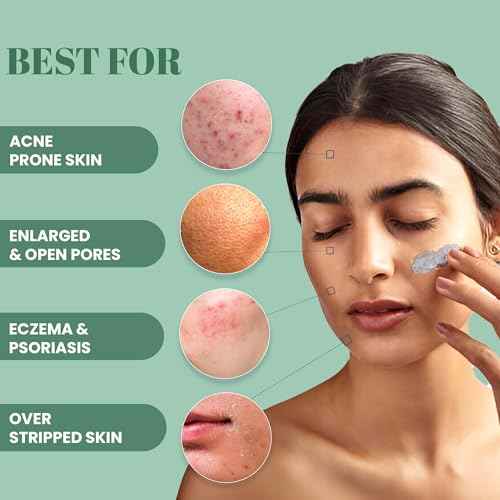 Wild Oak De Tan & Anti Acne Clay Mask | With 7x Power of Niacinamide, Bamboo Charcoal, Ashwagandha, Calendula, Manjistha & Licorice | Glow and Oil Control | Blackheads | Face Pack | 3.52 Oz