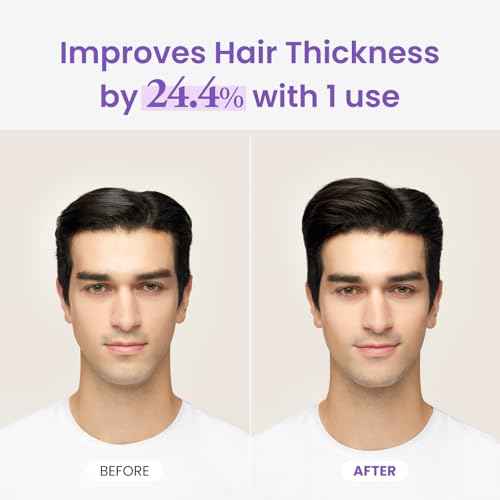 Dr.groot Rosemary Mint Oil Tonic for Hair Growth with Biotin, Hyaluronic Acid, Thickening & Scalp Nourishing. Korean Haircare. Sulfate-Free, Silicon-Free, Paraben-Free (3.38 fl oz/ 100ml)