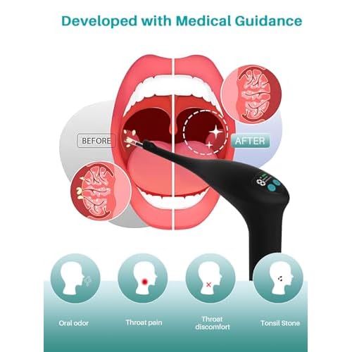Voraiya Visible Tonsil Stone Remover, Electronic Tonsil Stone Removal Kit with Camera and Led Light, APP WiFi Connection, 5 Level Suction Tonsil Stone Vacuum